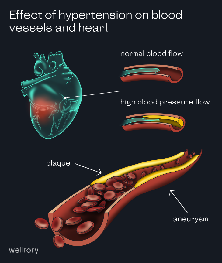 Blood_Pressure_1